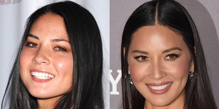 Olivia Munn's freckled complexion at Mercedes Benz Fashion Week in 2007 contrasts with her flawless, even-toned look at the 2019 Baby2Baby Gala