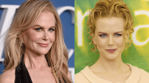 Nicole Kidman face